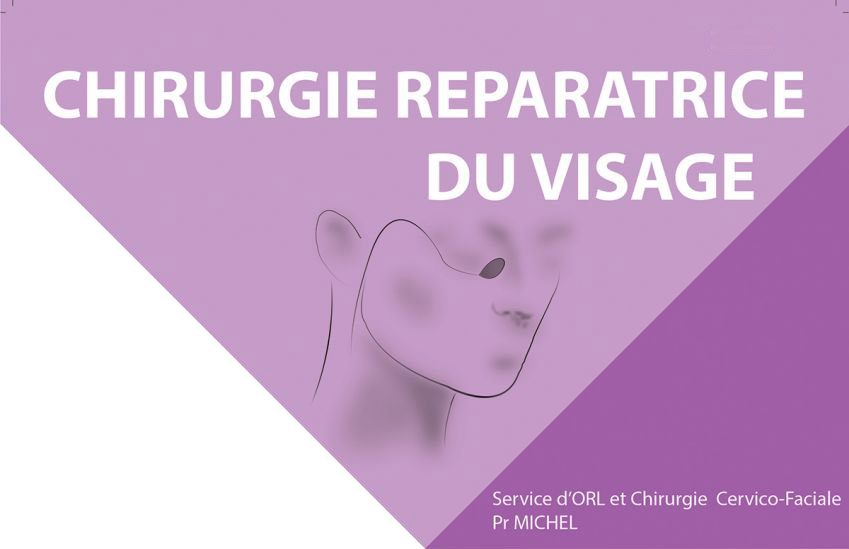 fiche pathologie du service ORL et chirurgie cervico-faciale de l'Hôpital de la Conception de Marseille