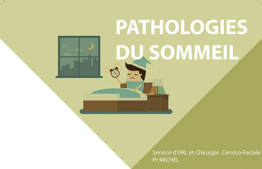 fiche pathologie du service ORL et chirurgie cervico-faciale de l'Hôpital de la Conception de Marseille